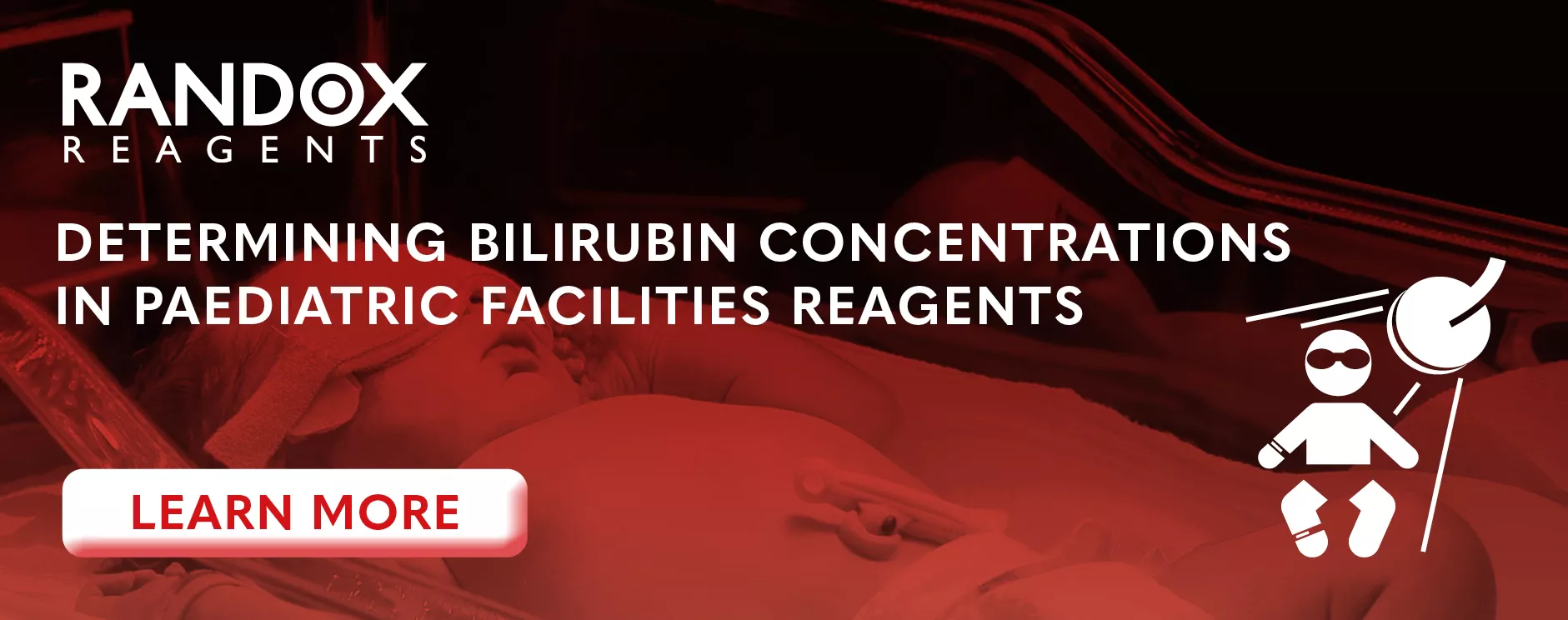 xMAY23-Determining-Bilirubin-blog-header.jpg.pagespeed.ic.EH8HRcYS94