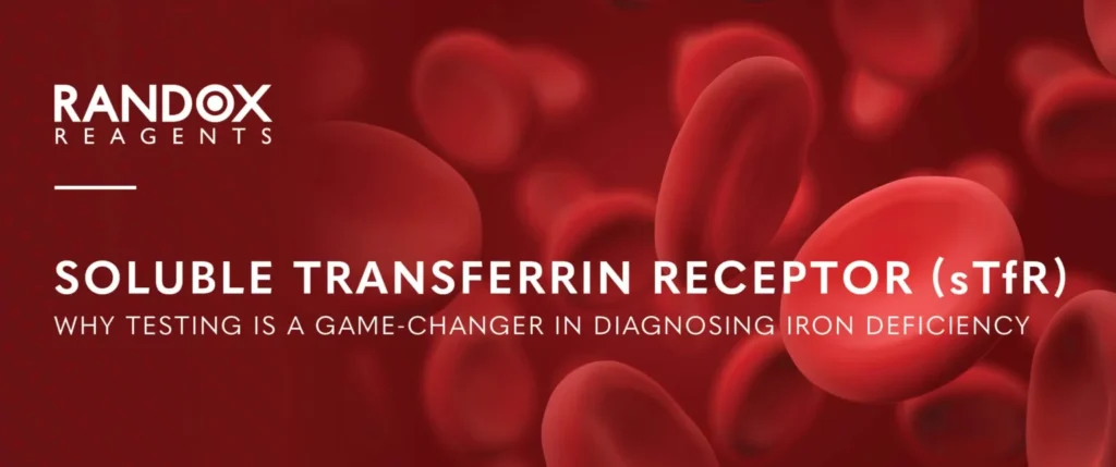 sTfR-Testing-Eshot-Banner-SEP25-1536x643